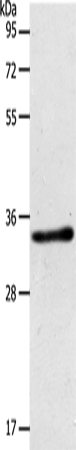 Anti-Human/Mouse ACY3 Antibody - ABMIUM