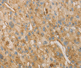 Anti-Human VTN Antibody - ABMIUM