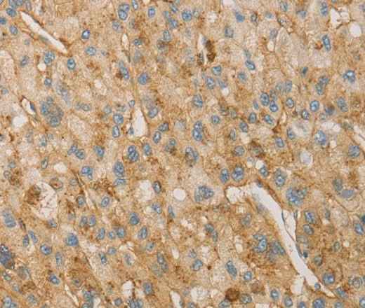 Anti-Human VTN Antibody