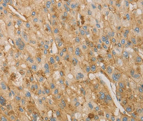 Anti-Human VTN Antibody - ABMIUM