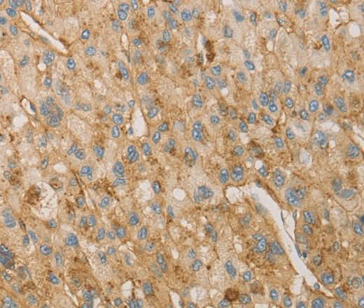 Anti-Human VTN Antibody - ABMIUM