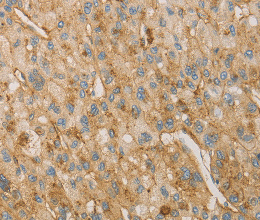 Anti-Human VTN Antibody - ABMIUM