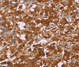 Anti-Human/Mouse/Rat DCBLD2 Antibody - ABMIUM