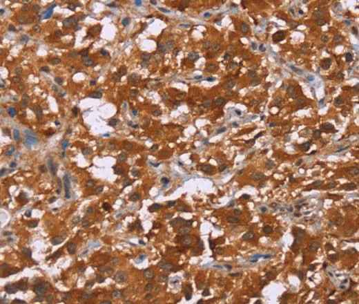 Anti-Human/Mouse/Rat DCBLD2 Antibody
