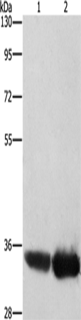 Anti-Human/Mouse AIMP1 Antibody - ABMIUM