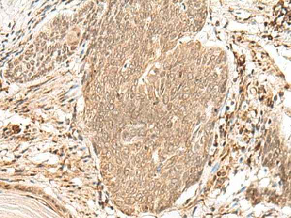 Anti-Human/Mouse/Rat VPS50 Antibody
