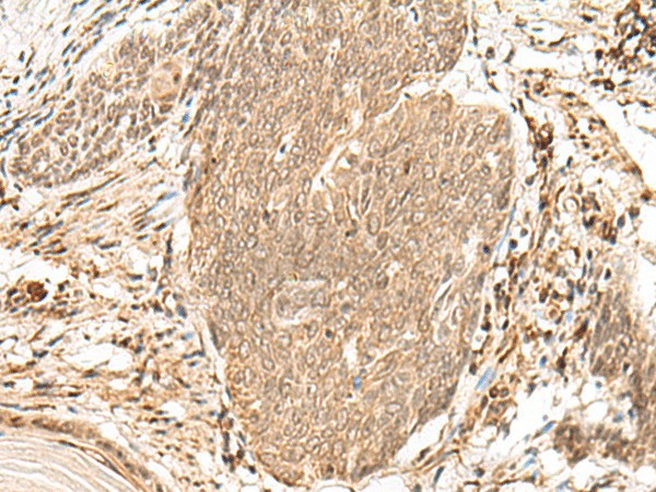 Anti-Human/Mouse/Rat VPS50 Antibody - ABMIUM