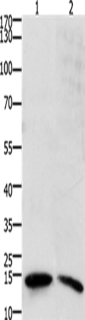 Anti-Human/Mouse/Rat SUMO2/3/4 Antibody - ABMIUM