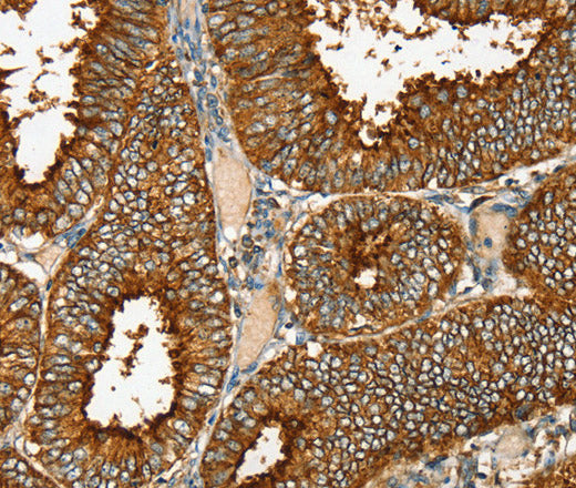 Anti-Human/Mouse RAB25 Antibody - ABMIUM