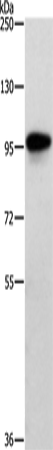 Anti-Human/Mouse/Rat TRAF3IP1 Antibody - ABMIUM