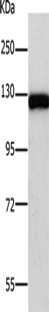 Anti-Human/Mouse/Rat PARP1 Antibody - ABMIUM