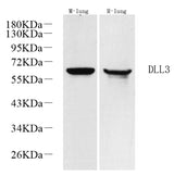 Western Blot analysis of various samples using DLL3 Polyclonal Antibody at dilution of 1:1000.