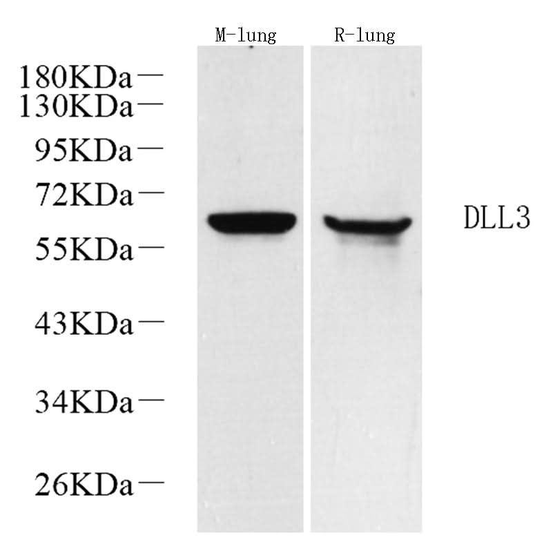 Western Blot analysis of various samples using DLL3 Polyclonal Antibody at dilution of 1:1000.