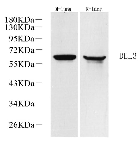 Western Blot analysis of various samples using DLL3 Polyclonal Antibody at dilution of 1:1000.