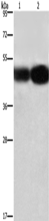 Anti-Human BSG Antibody - ABMIUM