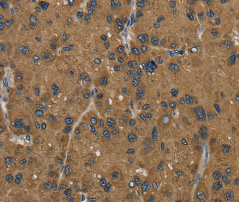 Anti-Human HSD17B2 Antibody - ABMIUM