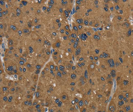 Anti-Human HSD17B2 Antibody - ABMIUM