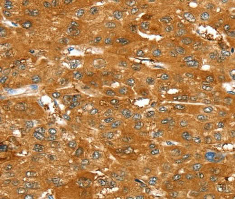 Anti-Human/Mouse/Rat ABCC9 Antibody - ABMIUM