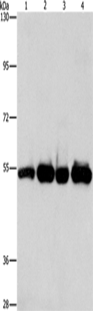 Anti-Human PDE4D Antibody - ABMIUM