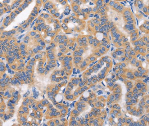 Anti-Human CARD17 Antibody - ABMIUM