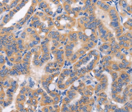 Anti-Human CARD17 Antibody - ABMIUM