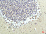 Immunohistochemistry of paraffin-embedded Human brain tissue using PPARD Monoclonal Antibody at dilution of 1:200.