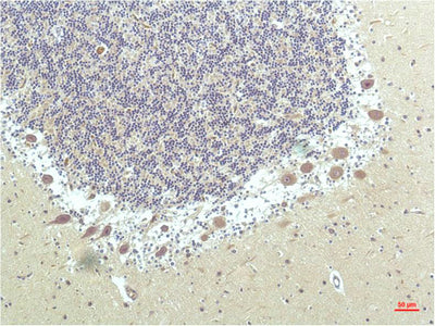 Immunohistochemistry of paraffin-embedded Human brain tissue using PPARD Monoclonal Antibody at dilution of 1:200.