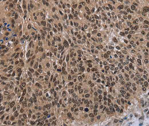 Anti-Human DLX4 Antibody