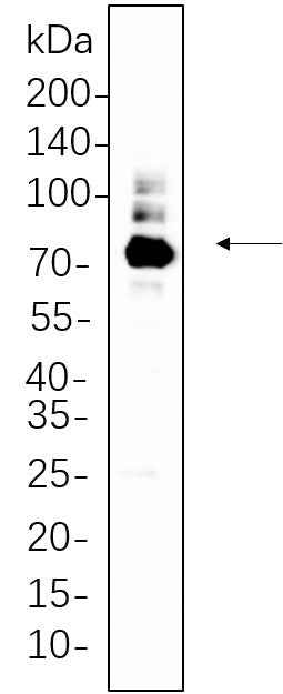 Anti-Human/Mouse/Rat PKC α Antibody [B660] - ABMIUM