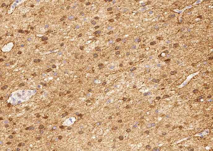 Anti-Human ENO2 Antibody [A1079] - ABMIUM