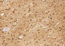 Anti-Human ENO2 Antibody [A1079] - ABMIUM