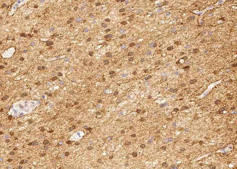 Anti-Human ENO2 Antibody [A1079] - ABMIUM