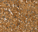 Anti-Human TBC1D1 Antibody - ABMIUM