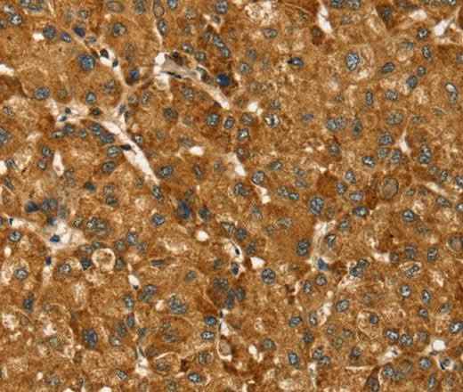 Anti-Human TBC1D1 Antibody