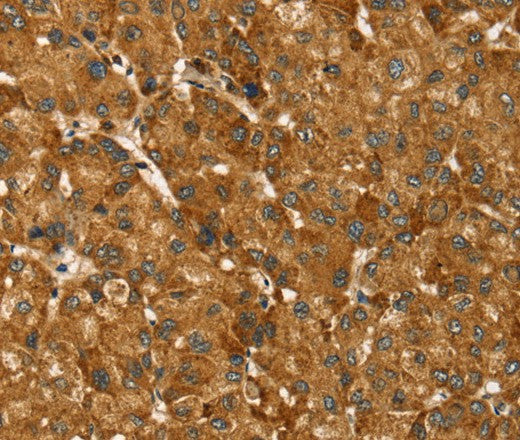 Anti-Human TBC1D1 Antibody - ABMIUM
