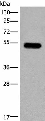 Western blot analysis of Mouse brain tissue lysate using CDKL2 Polyclonal Antibody at dilution of 1:250