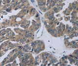 Anti-Human TP53AIP1 Antibody - ABMIUM