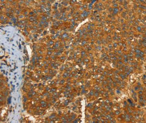 Anti-Human/Mouse/Rat PFKFB1 Antibody