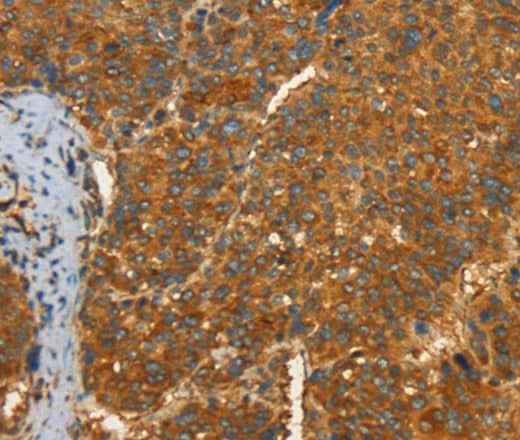 Anti-Human/Mouse/Rat PFKFB1 Antibody