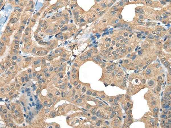 Anti-Human/Mouse CABP5 Antibody