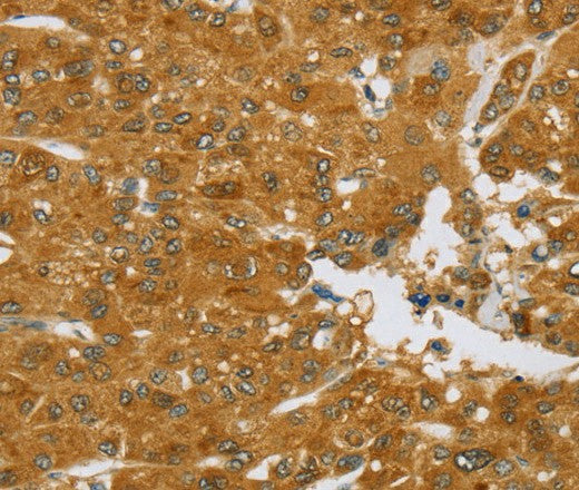 Anti-Human/Mouse TNFSF13 Antibody - ABMIUM