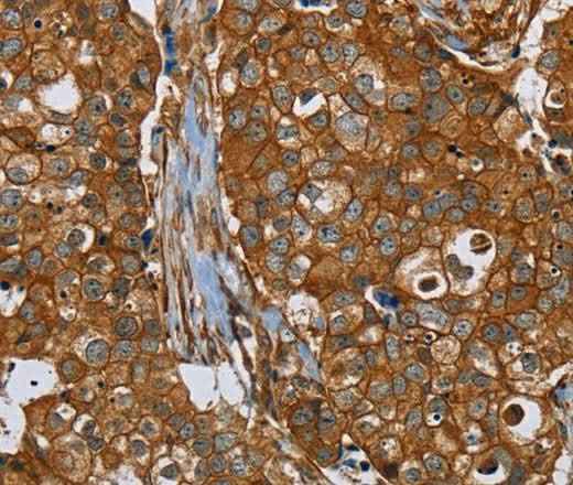 Anti-Human/Mouse/Rat PLEC Antibody