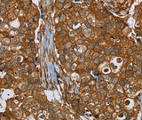 Anti-Human/Mouse/Rat PLEC Antibody - ABMIUM