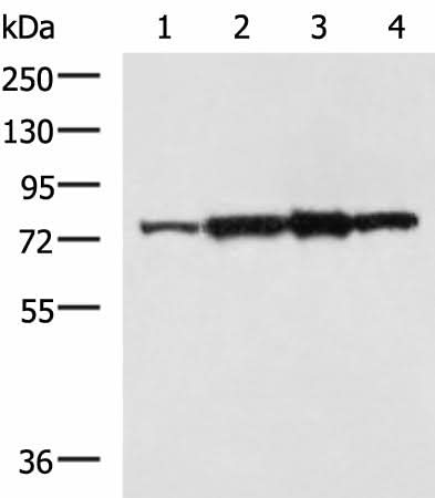 Western blot analysis of Rat heart tissue A172 cell NIH/3T3 cell TM4 cell lysates using CAPN6 Polyclonal Antibody at dilution of 1:800