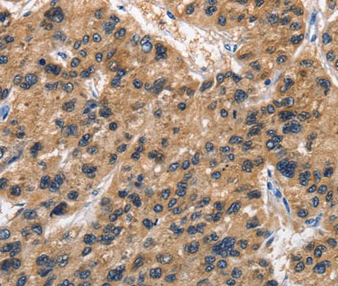 Anti-Human ABI3BP Antibody - ABMIUM