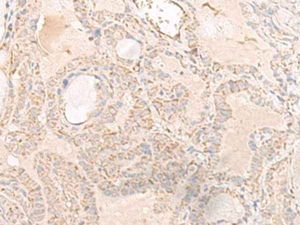 Anti-Human IGHA1 Antibody