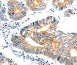 Anti-Human/Mouse/Rat NTRK1 Antibody - ABMIUM