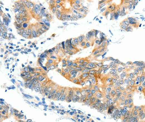 Anti-Human/Mouse/Rat NTRK1 Antibody