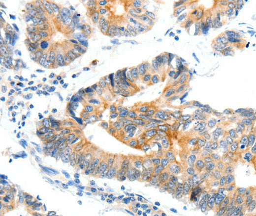 Anti-Human/Mouse/Rat NTRK1 Antibody - ABMIUM