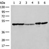 Western blot analysis of Hela A375 Human fetal liver tissue Human fetal brain tissue HepG2 cell and Mouse brain tissue lysates using FLOT2 Polyclonal Antibody at dilution of 1:350